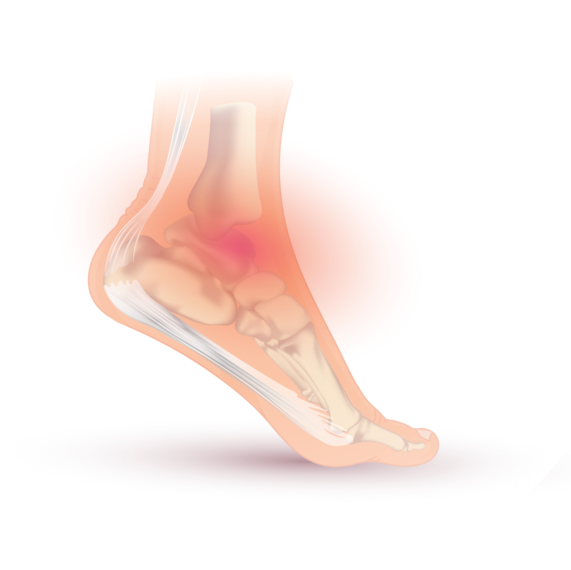 https://www.injurymap.com/diagnoses/ankle-sprain